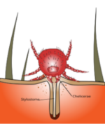 Laufmilben